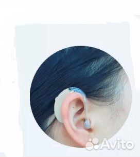 Слуховой аппарат ReSound Alera AL477/87-dviw
