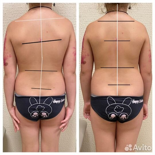 Костоправ мануальщик