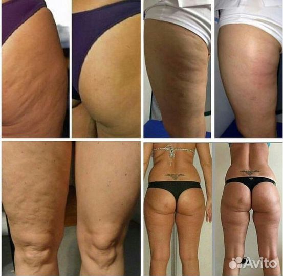 Экспресс похудение когда нет времени