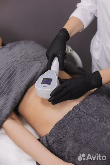 RF-лифтинг, омоложение -10 лет