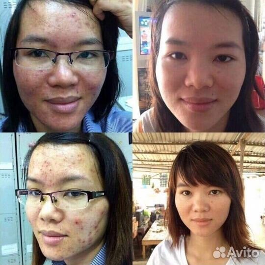 M GEL М гель / Гель millenium