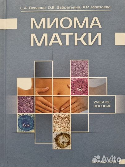 Миома матки Леваков Зайратьянц Мовтаева