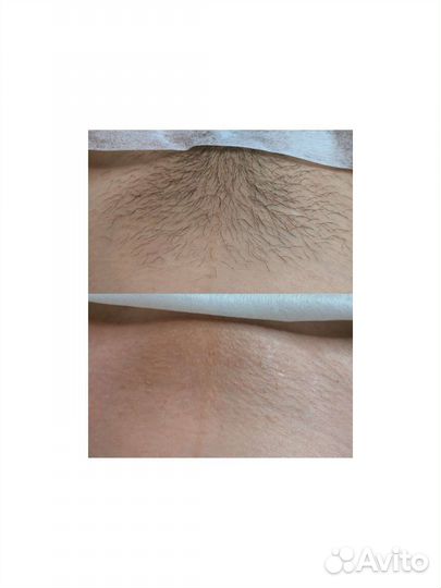 Массаж Шугаринг Чебоксары сзр Афанасьева