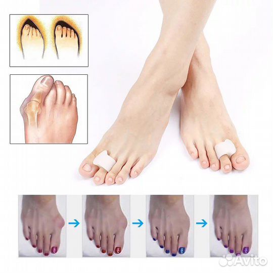 Разделитель для пальцев