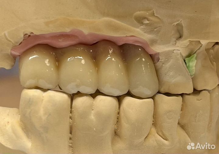 Зубной техник