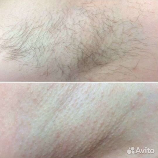 Шугаринг,маникюр