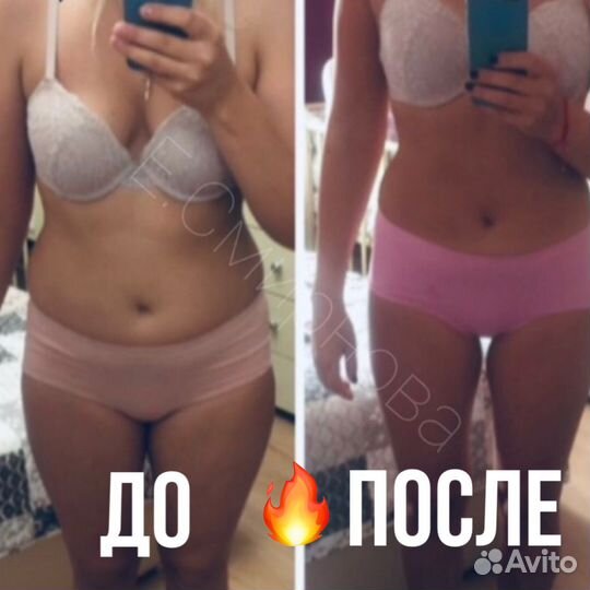 Аппаратный массаж liposculpt