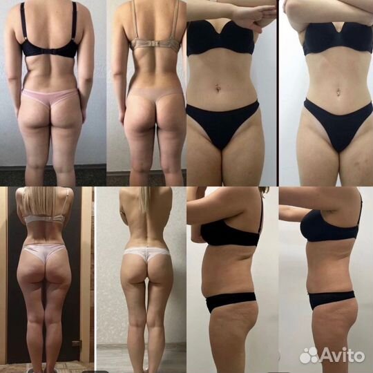 Аппаратный массаж