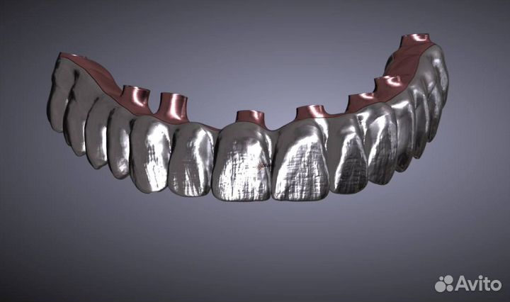 Blender for dental (B4D) iBar (балки) и все модули