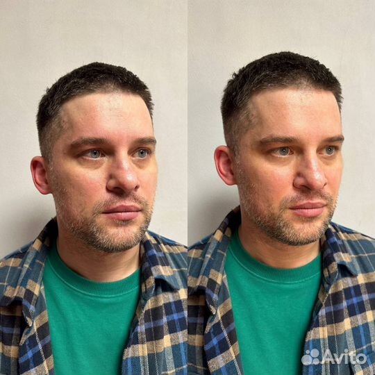 Скульптурный массаж лица