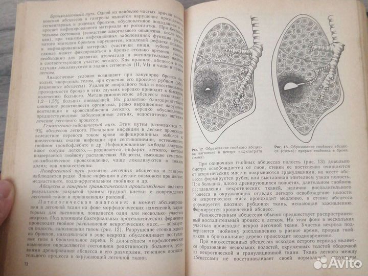 Хирургические болезни книга 1987 Г. для студентов