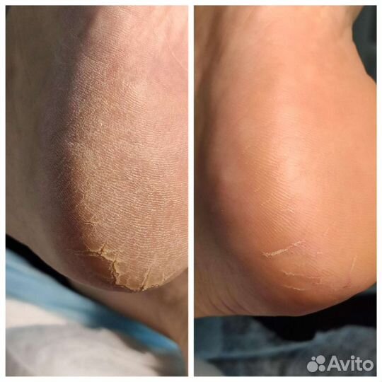 Маникюр Педикюр Набережные Челны 45/05