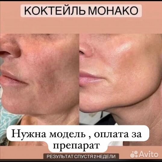 Косметолог избербаш