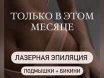 Лазерная эпиляция