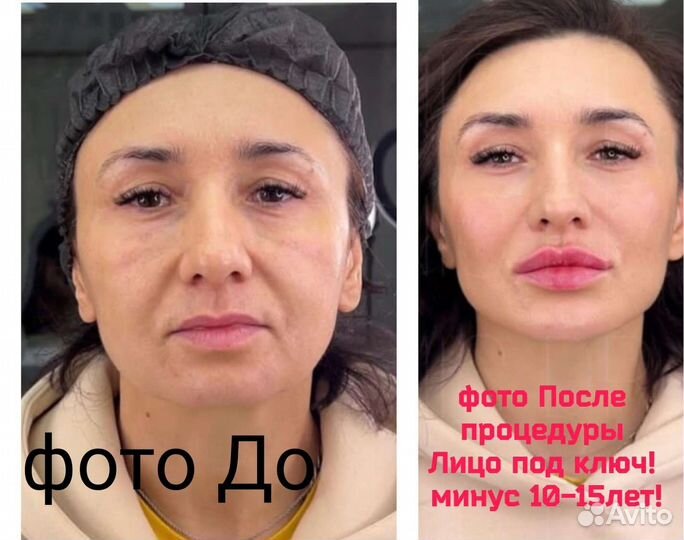 Услуги косметолога