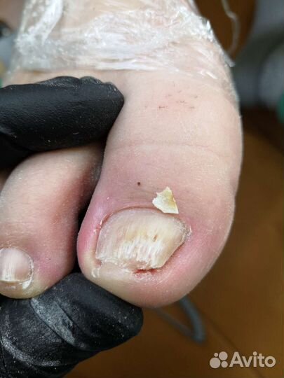 Услуги подолога