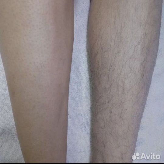 Депиляция шугаринг эпиляция