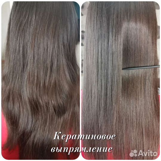 Ботокс/Нанопластика/Флисинг