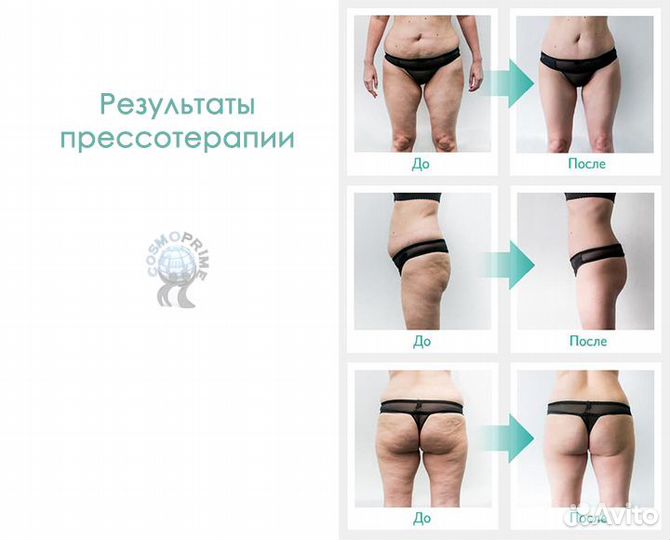 Аппарат вакуумно-роликового массажа с гарантией