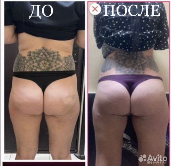 Массажист с мед.образованием