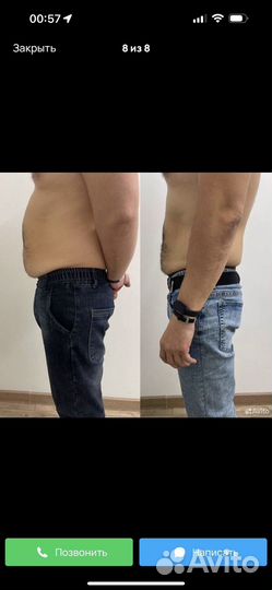 Криолиполиз модель на похудение