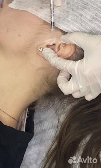 Точка голода, гиперсушка, липолитики