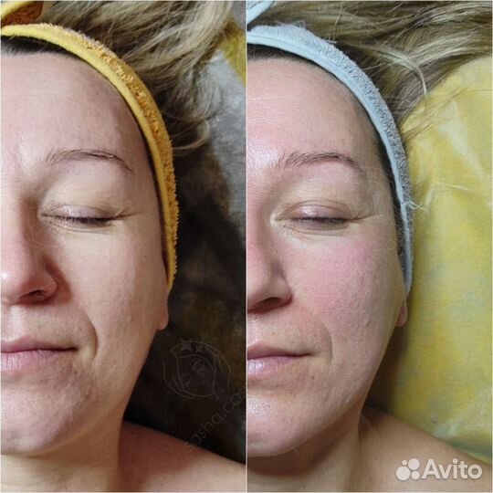 Массаж и чистка лица