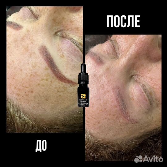 Ремувер для удаления перманента микроблейдинга