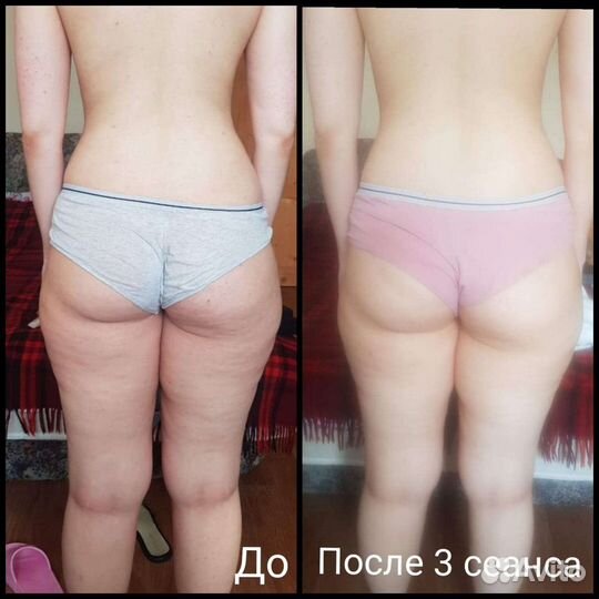 Авторский ручной массаж