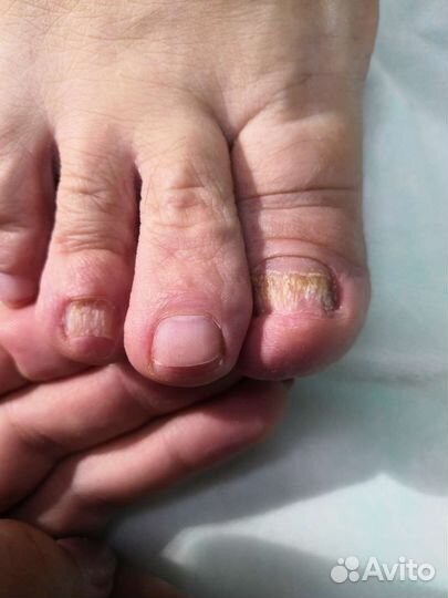 Услуги подолога