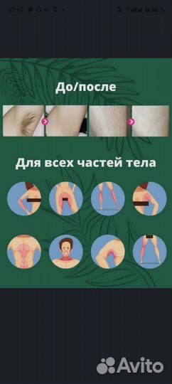 Фотоэпилятор IPL