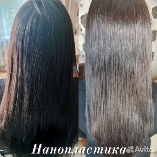 Ботокс/Нанопластика/Флисинг