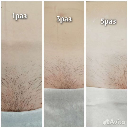 Шугаринг ЖК Цветы сахар/ воск, гл чистка бикини