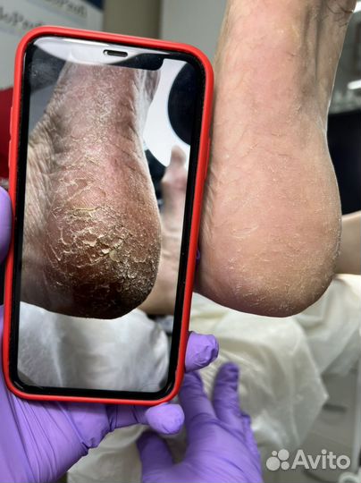 Маникюр,педикюр,подолгия