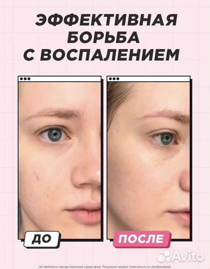 Патчи-наклейки от прыщей уход для лица