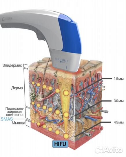 Ультраформер, Ютимс, Ульфит аренда