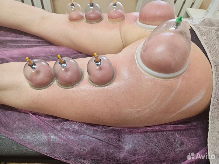 Антицеллюлитный массаж