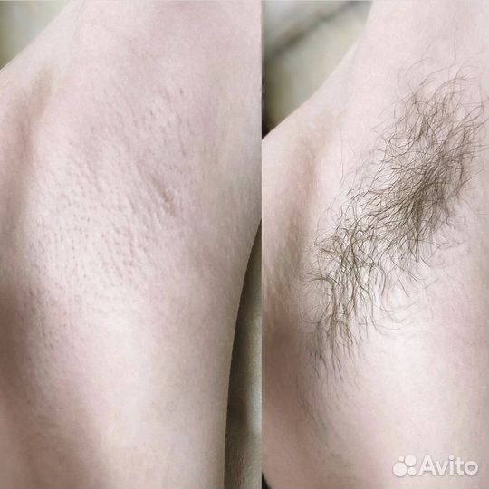Мастер шугаринга
