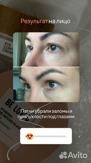 Корейские патчи с лифтиг эффектом