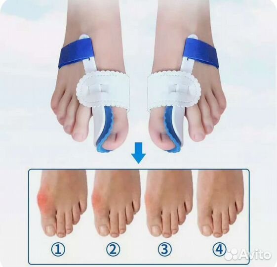 Корректор кости большого пальца