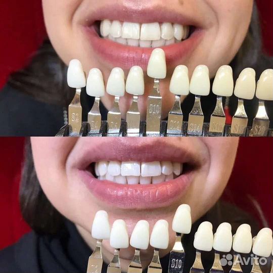 Белоснежные зубы