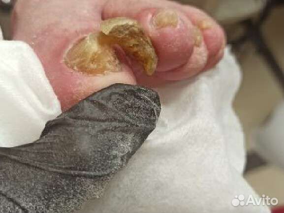 Услуги подолога