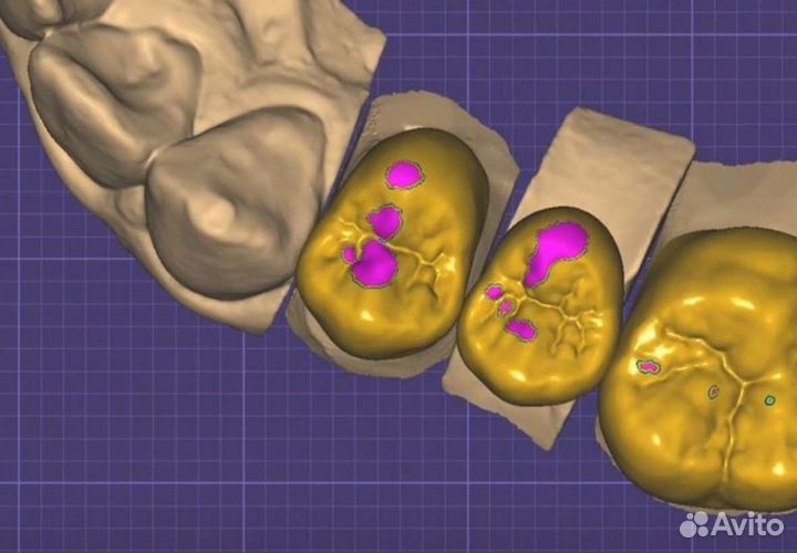 Курс по ExoCad, программа в подарок