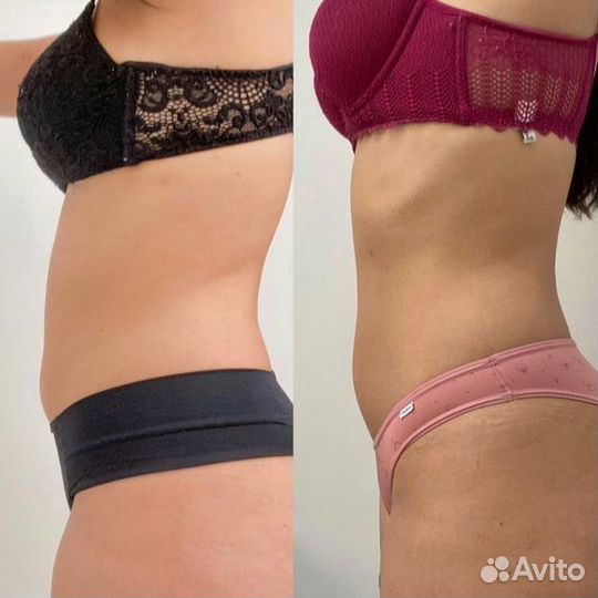 Аппаратный массаж