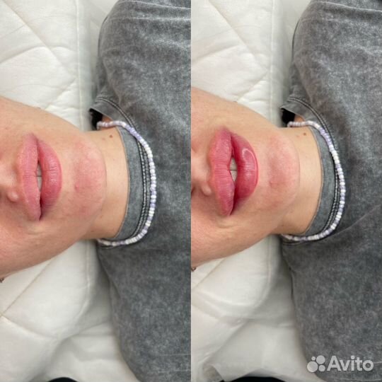 Обучение косметологов