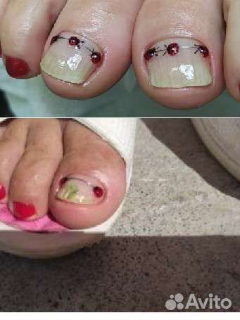 Мед. Педикюр1500/Титан1500