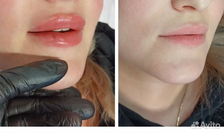 Услуги косметолога