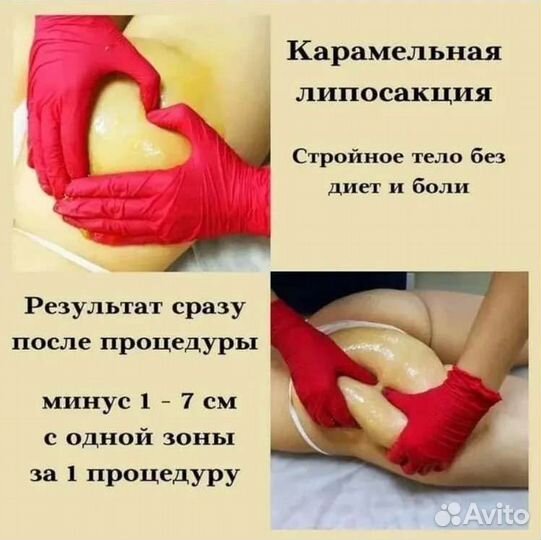 Антицеллюлитный массаж,массаж лица, spa-процедуры