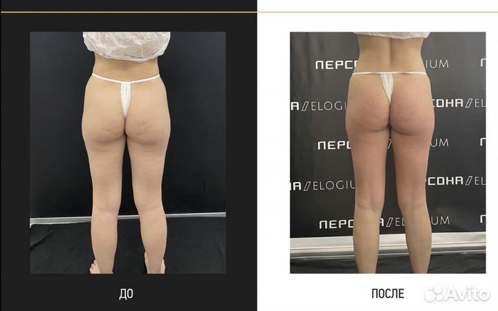 Услуги массажиста