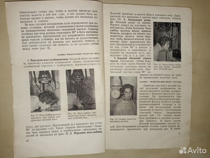 Рентгенодиагностика заболеваний лицевого черепа. 1